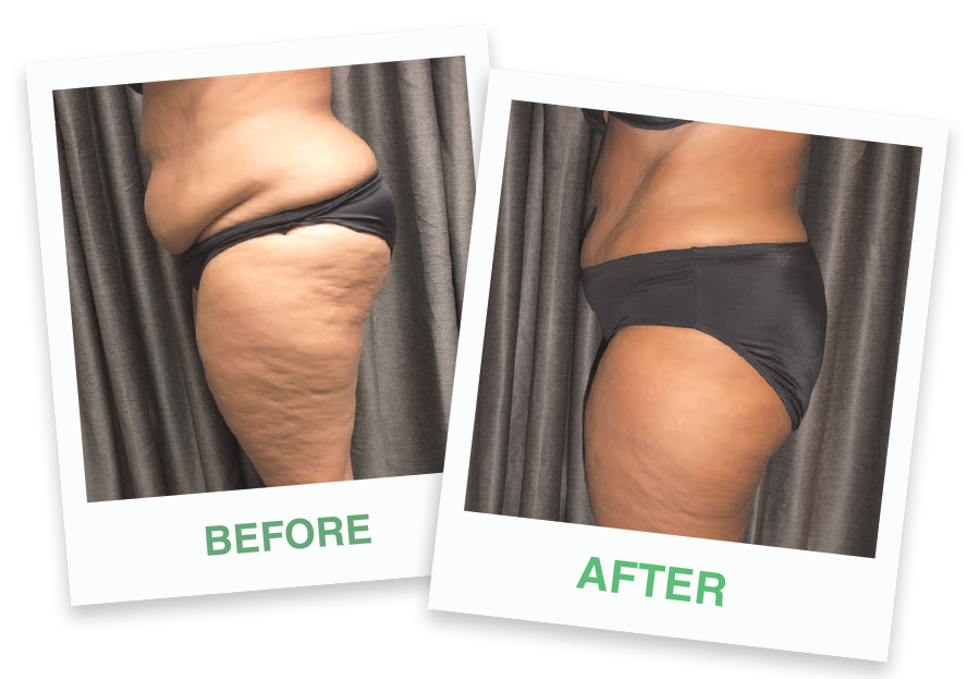 EMERALD LASER in Ridgewood