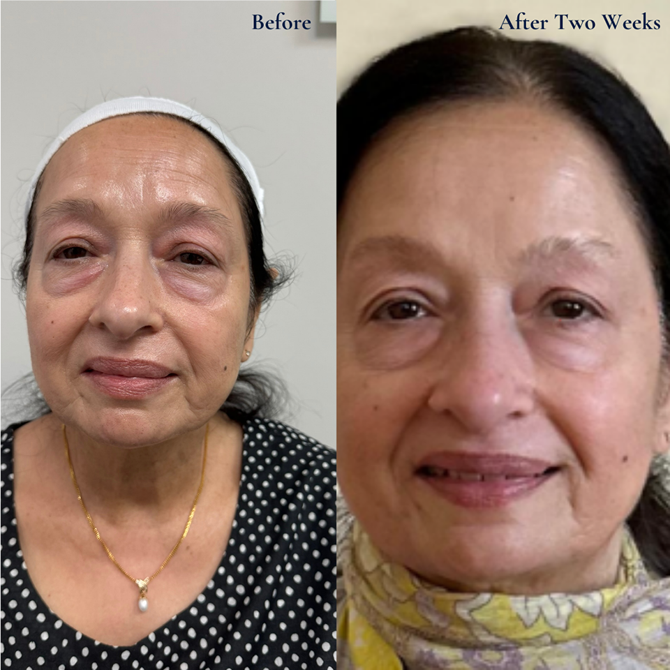 Design Medical Group | Botox reg , Emerald Laser and Bioidentical Hormones