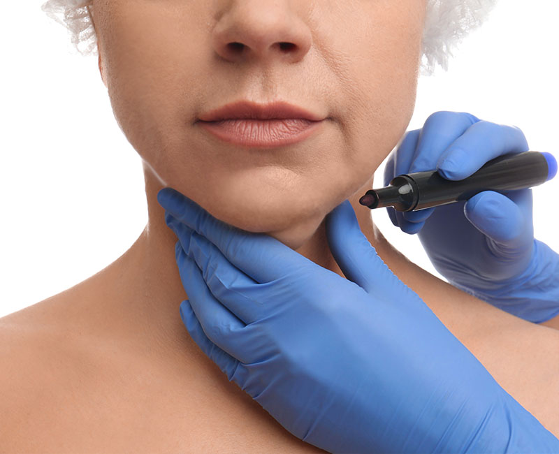 Fat Removal Doctor in Ridgewood