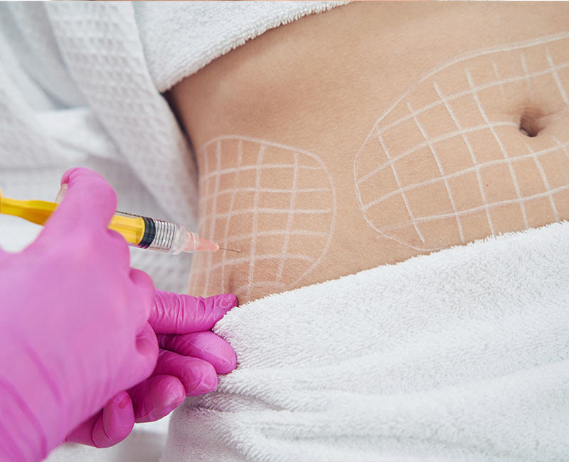 EMERALD LASER in Ridgewood