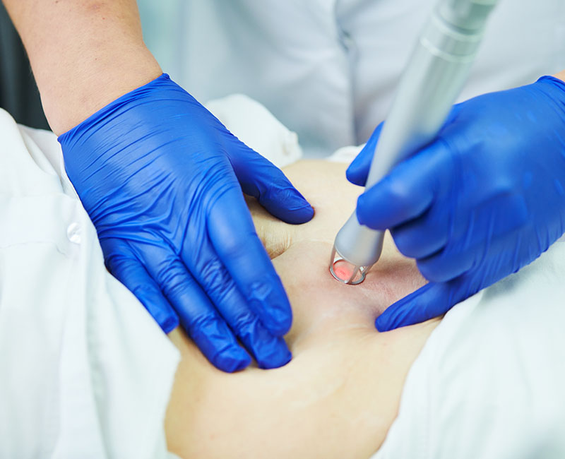 EMERALD LASER in Ridgewood